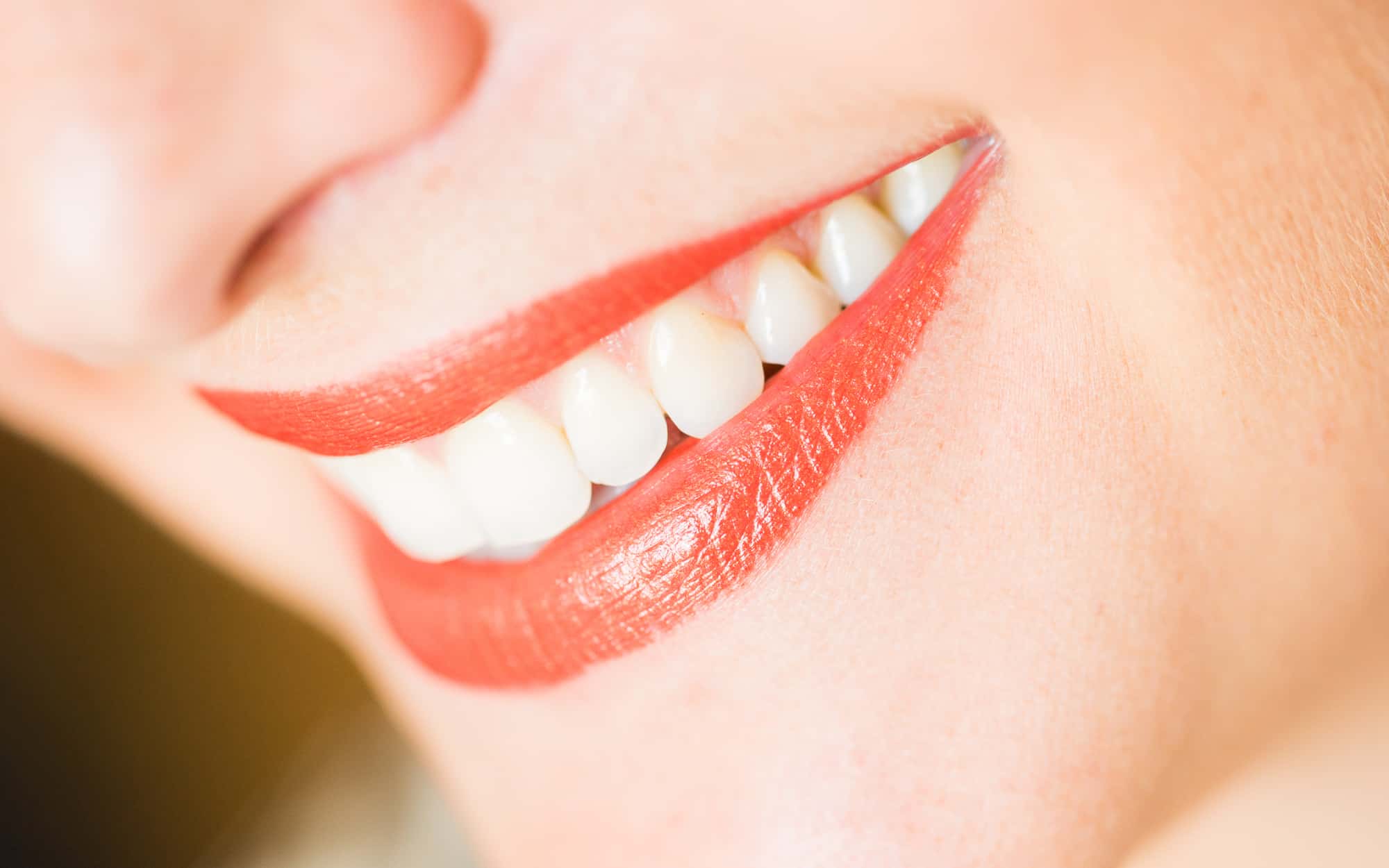 Unser Ziel ist Ihre lebenslange Zahn- und Mundgesundheit - ein lächelnder Frauenmund mit ästhetisch schönen Zähnen
